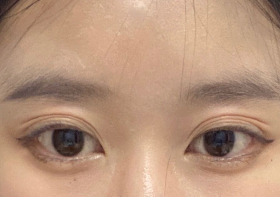 戴美瞳会让眼珠子变小吗 我今天摘美瞳,摘下来发现眼珠子真的越来越小