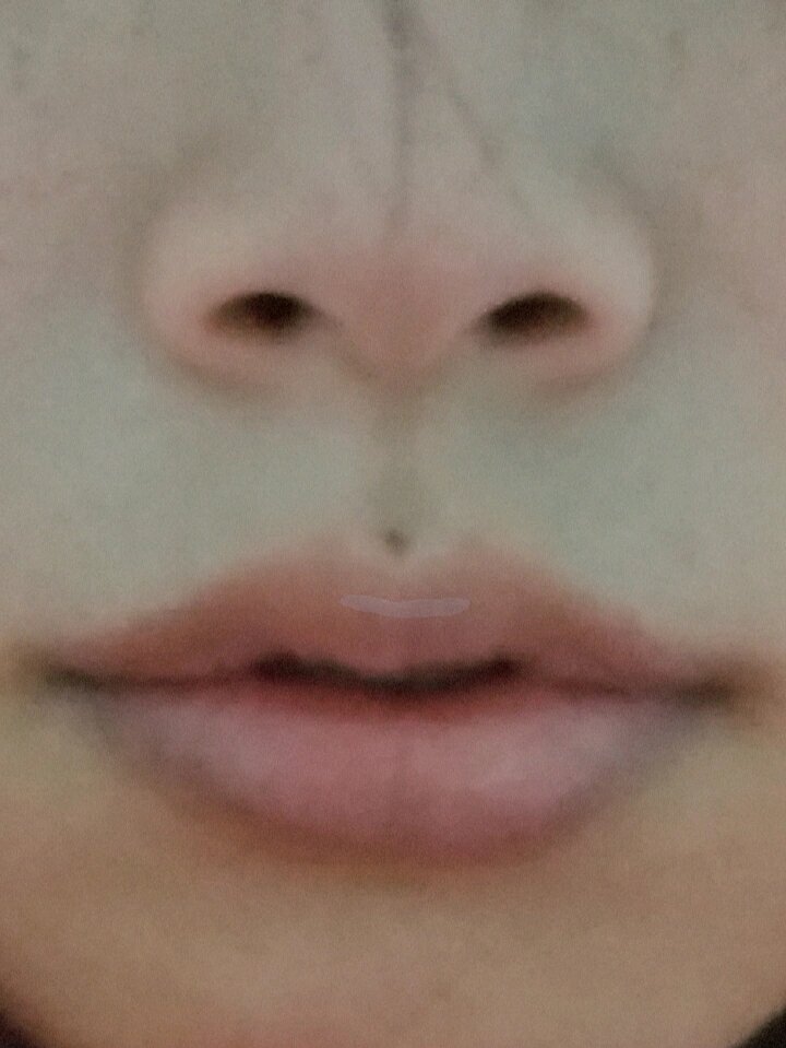 双生痣好吗?为什么好多人说.@倩影映碧纱山下的动态