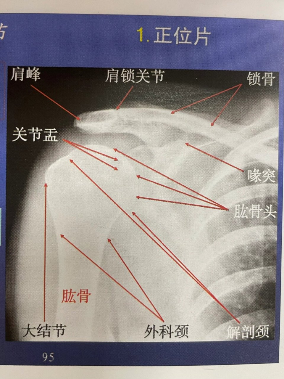 肩峰喙突图片