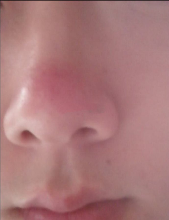 说啥鼻子也不能发红,鼻子一旦发红特别是鼻头位置,一定会破财的,鼻子