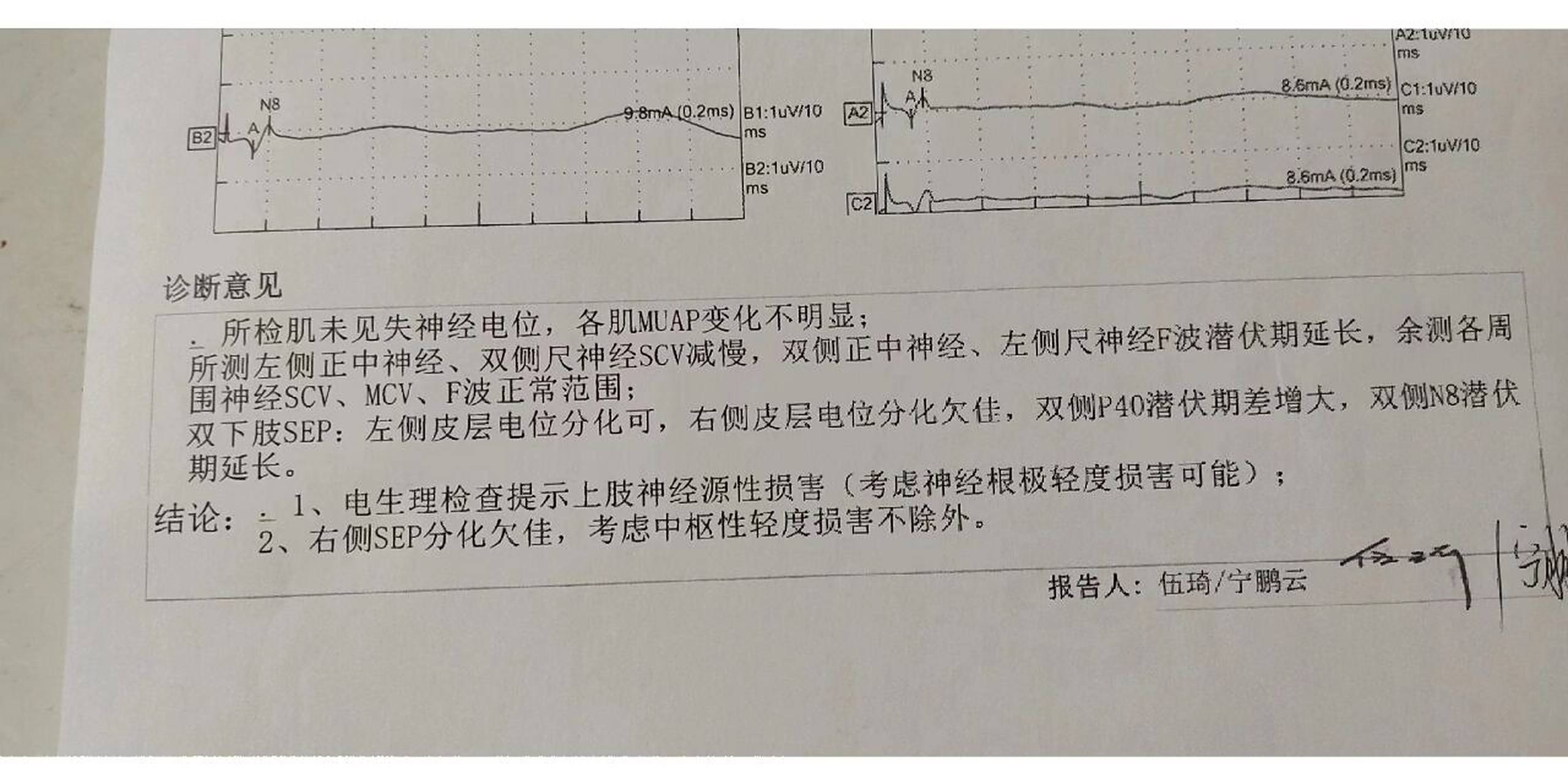肌电图/诱发电位报告 四肢无力,踩棉花感,行走不稳,站立摇晃