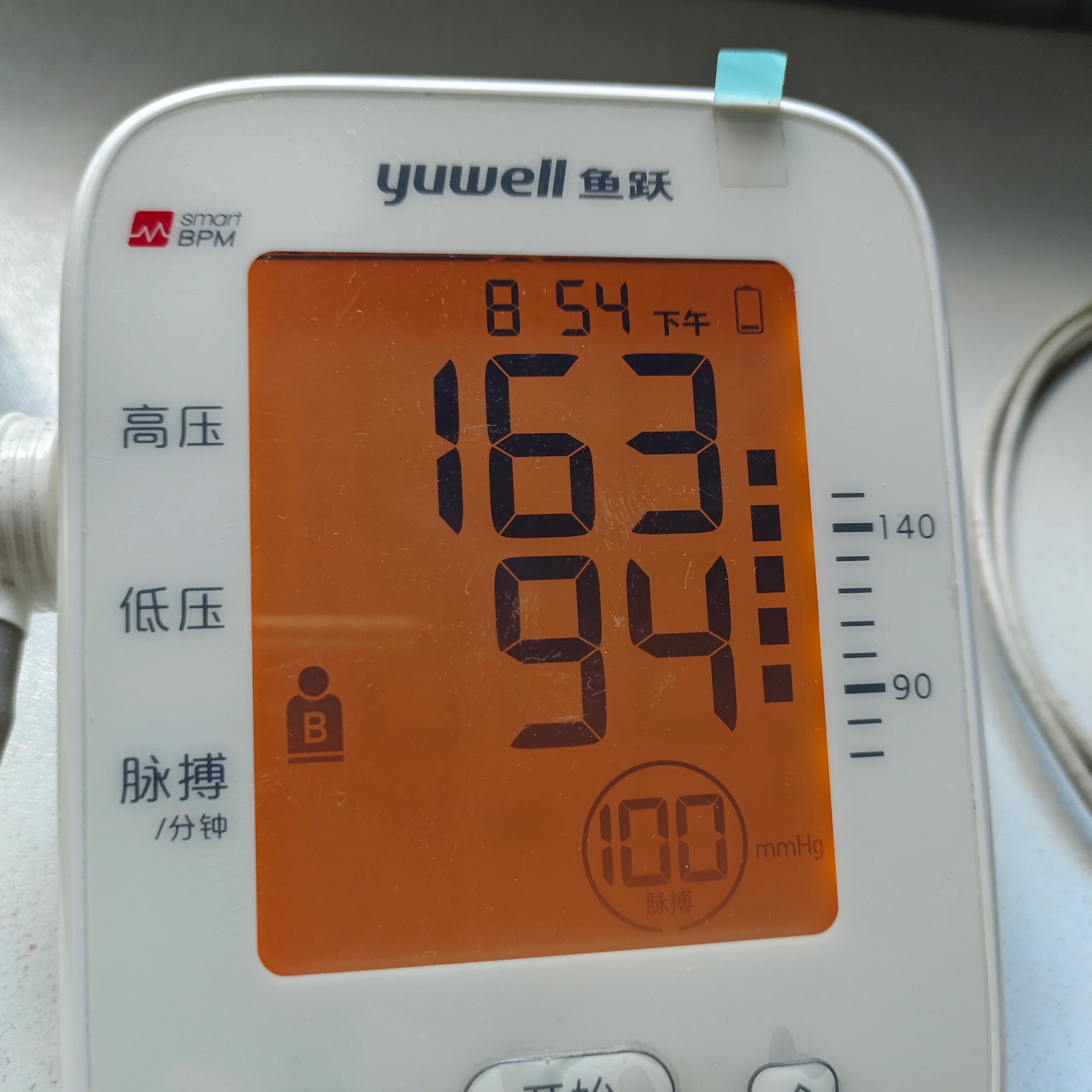 2日早上感觉不舒服,右眼睛红肿,家族遗传高血压,血压仪一侧,血压飙升