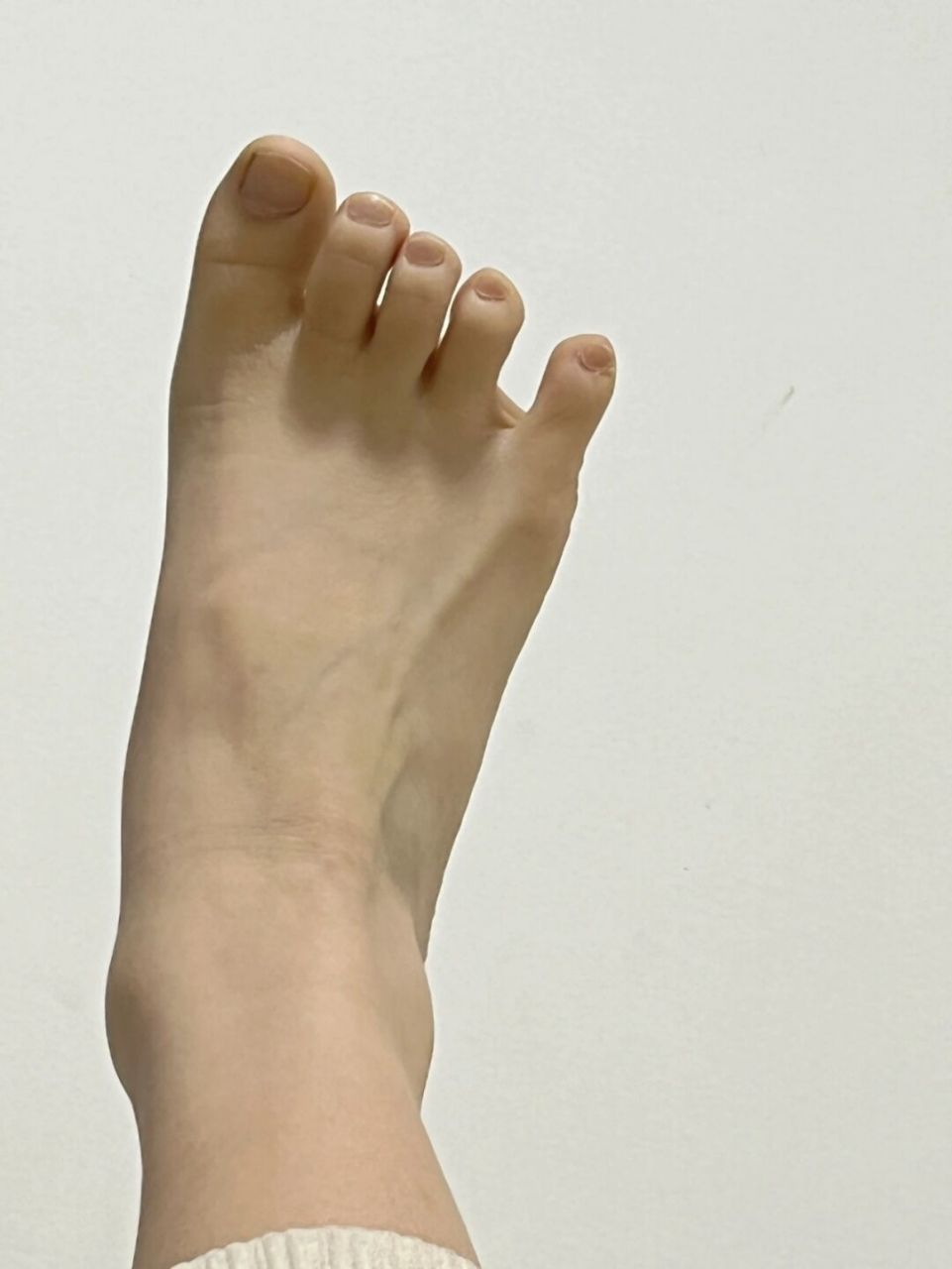 36码近10cm宽的脚还有救吗 买鞋只能买37(挤脚)38(不挤脚但是大得能塞