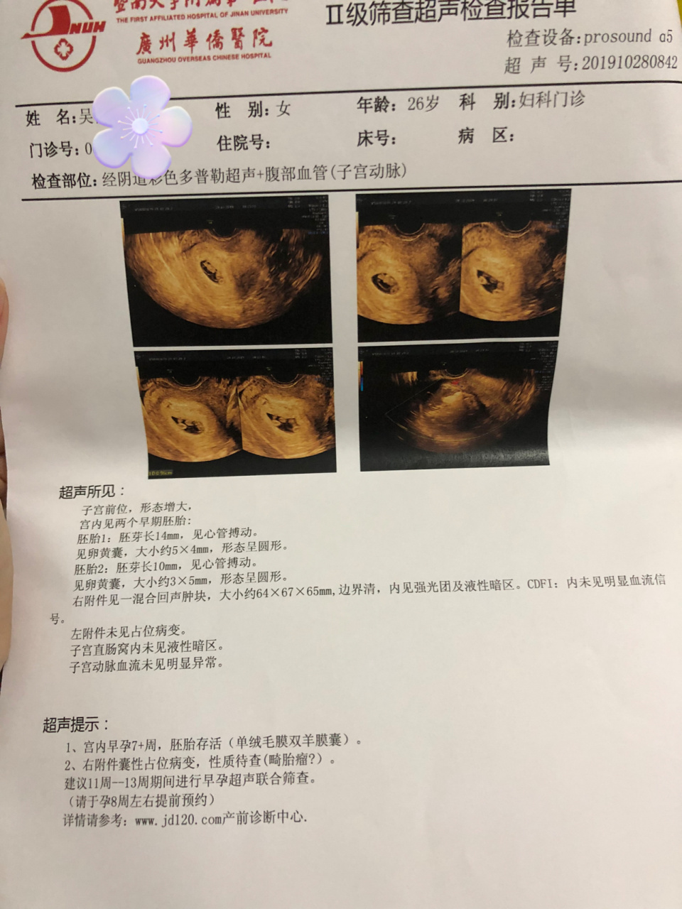 双胎发现畸胎瘤的我是安全怎么渡过孕期的 都怪自己大意了,几年前就