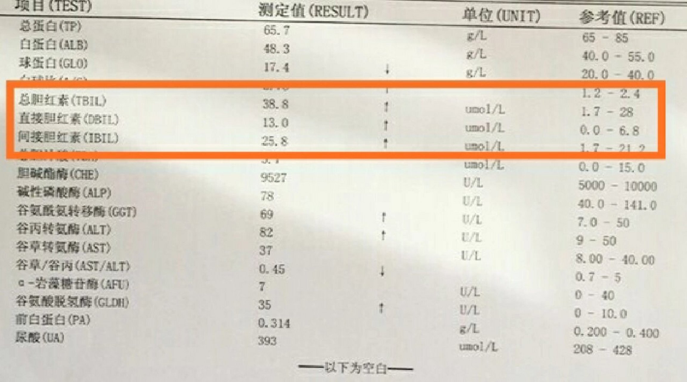 总胆红素偏高要紧吗图片