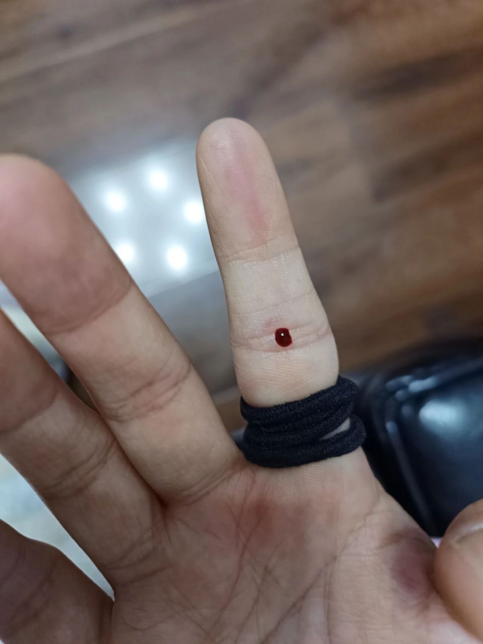 刺四缝不止调积食那么简单 扎四缝的作用有消食导滞,祛痰化积.