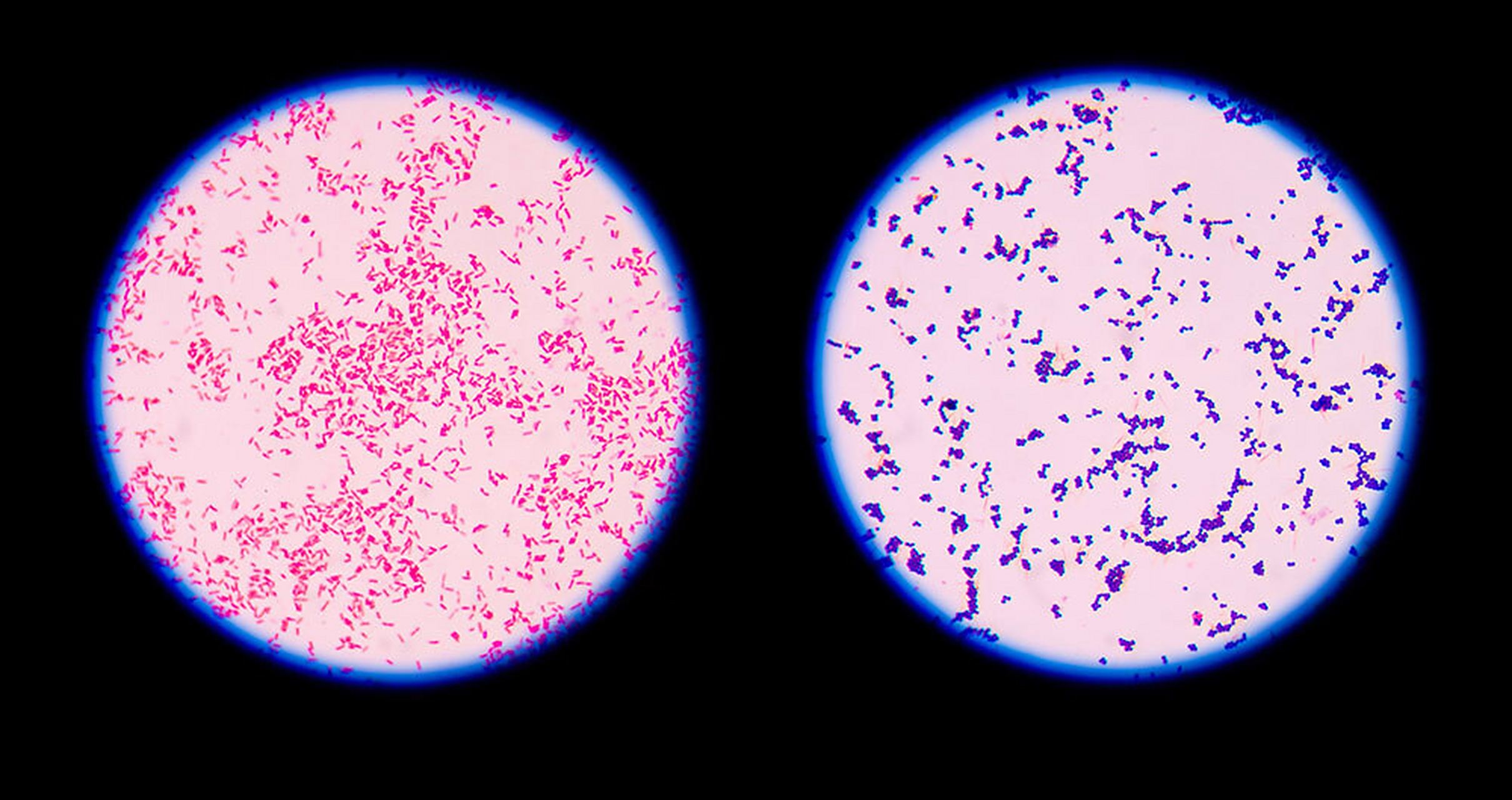 革兰氏染色液简介: 革兰氏染色是一种差异染色方法,用于根据细菌细胞