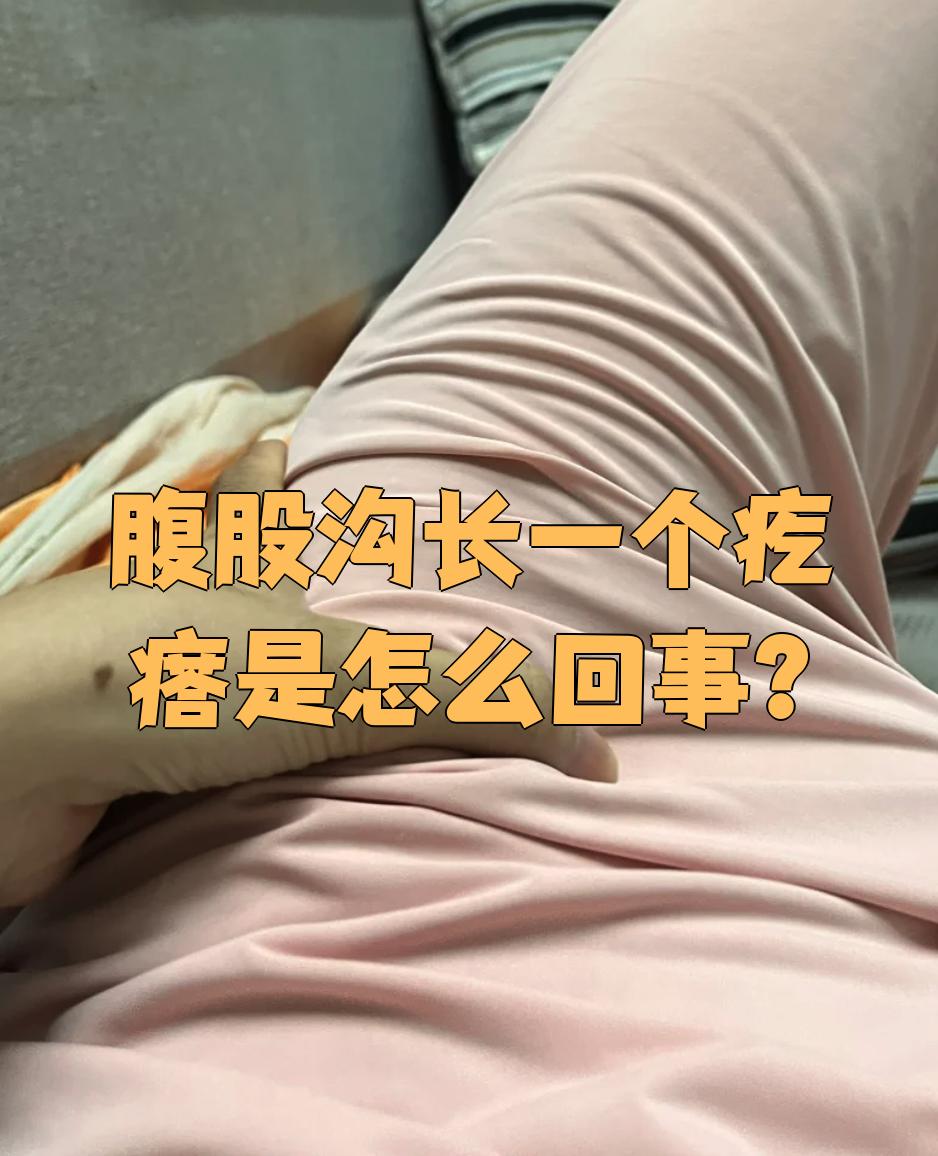 腹股沟长疙瘩可能和过敏,淋巴结肿大,皮脂腺囊肿这些情况有关