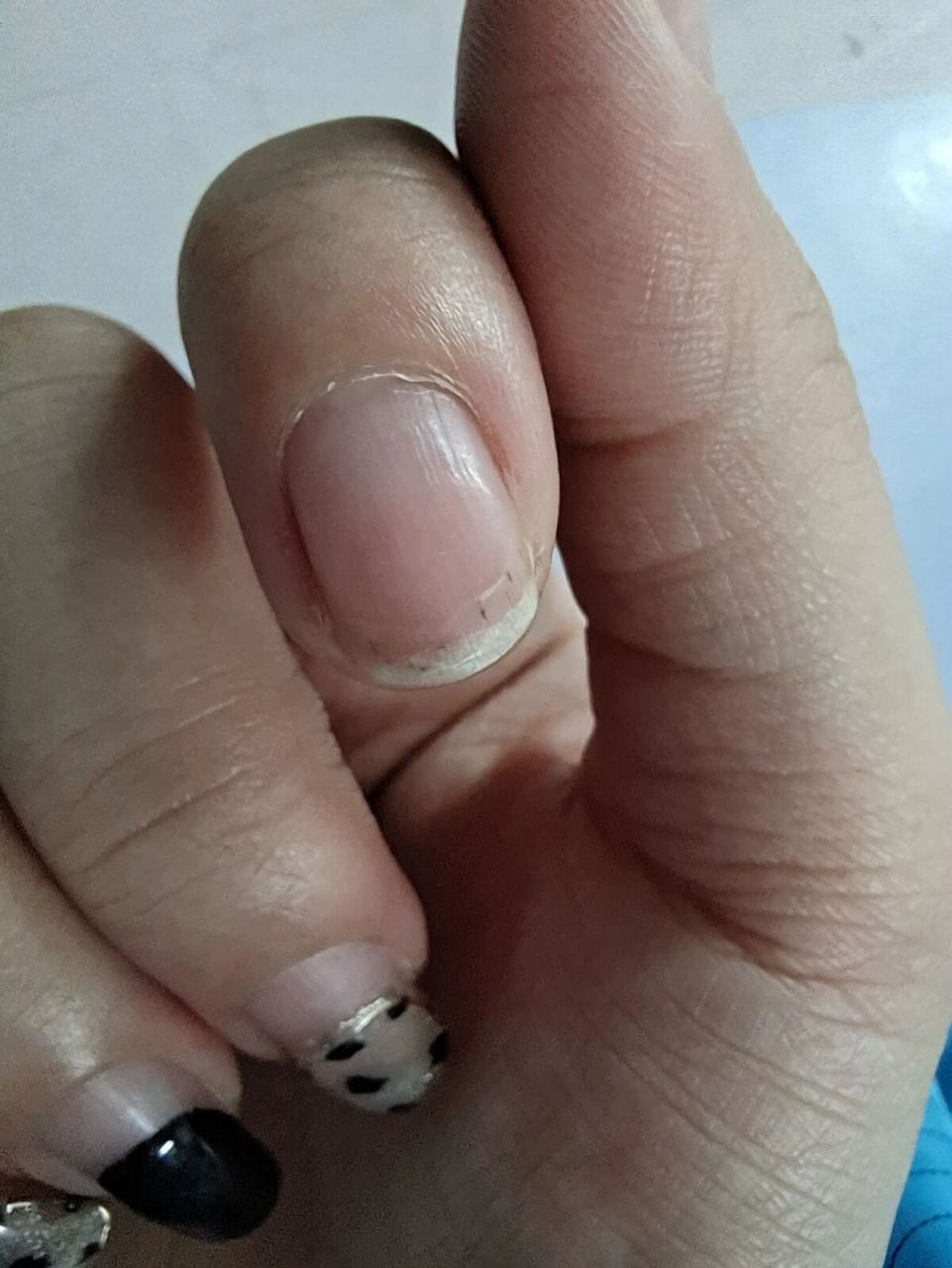 姐妹们,最近发现手指上的这个黑线怎么越长越多了呀?