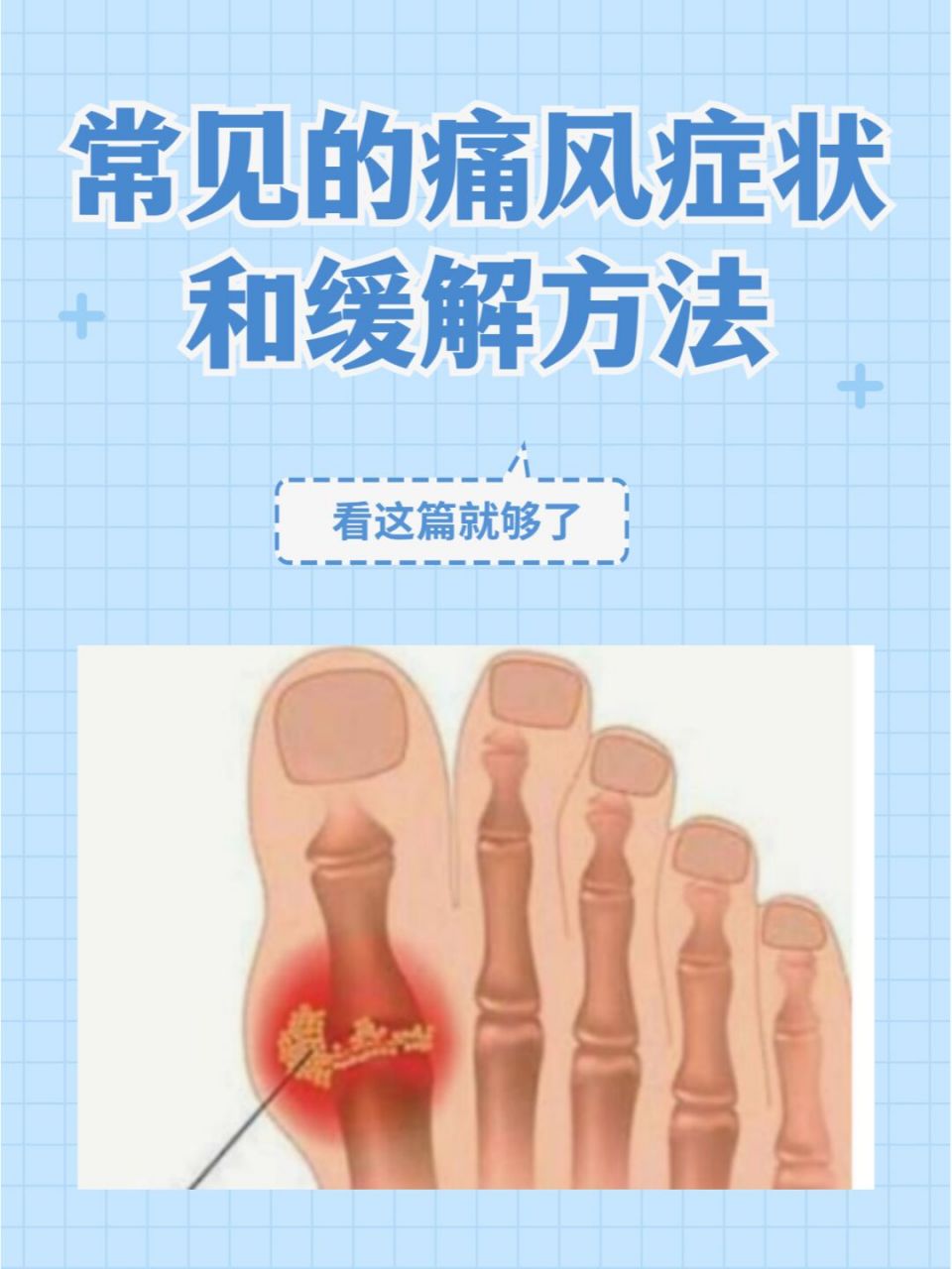 为了避免难忍的疼痛,下面给你们介绍几种常见的痛风症状