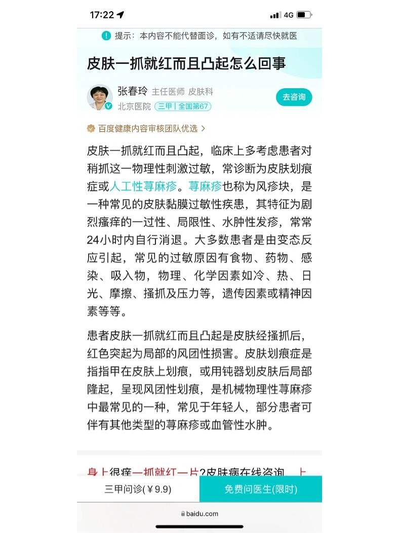 人工荨麻疹能活多少年图片