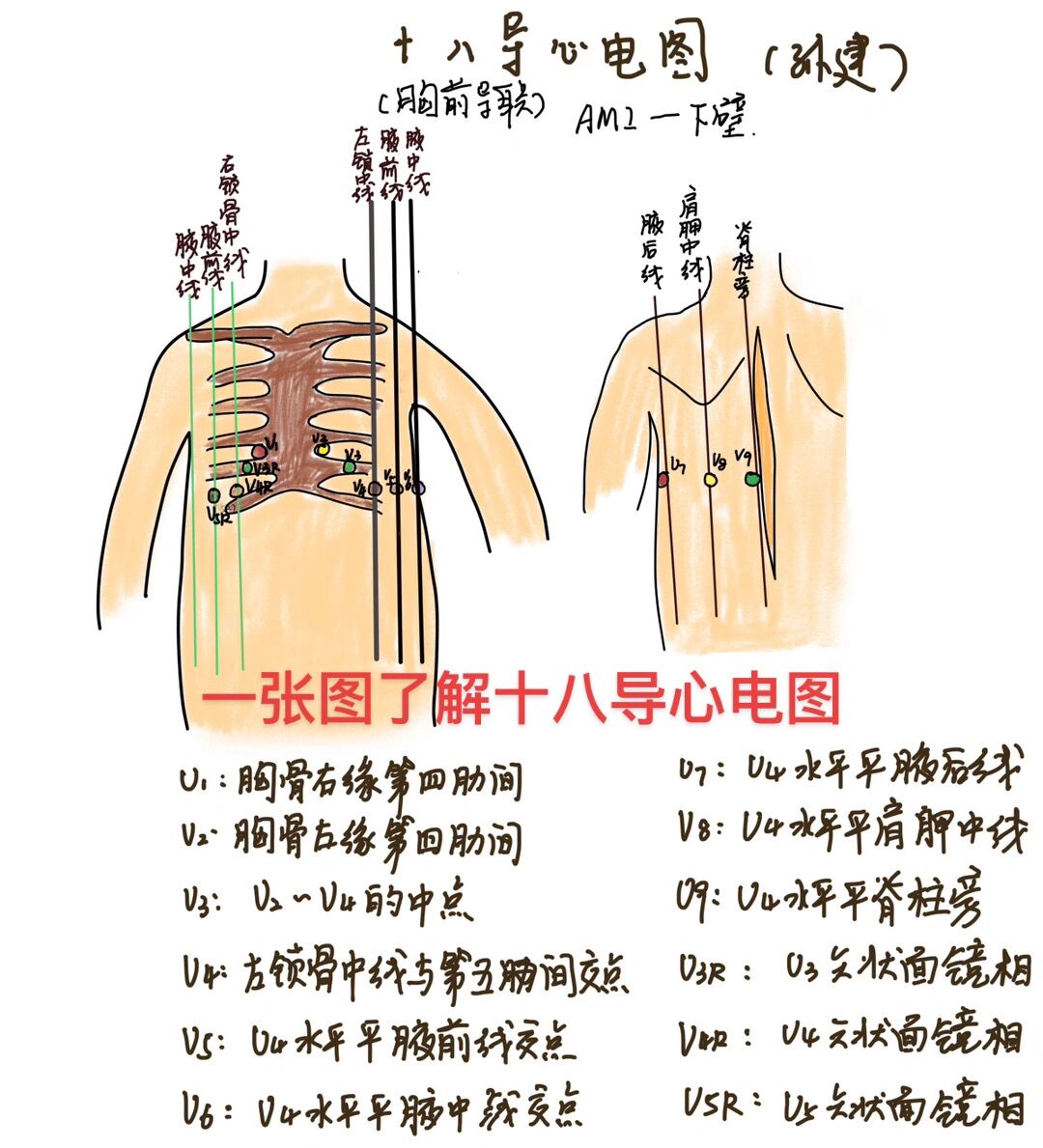 心电图18导联位置图解图片