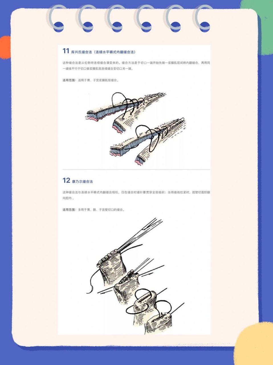 外科13种缝合方法图解图片