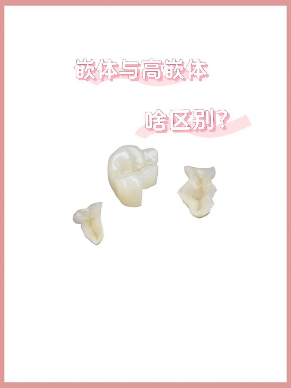 嵌体与高嵌体 啥区别?