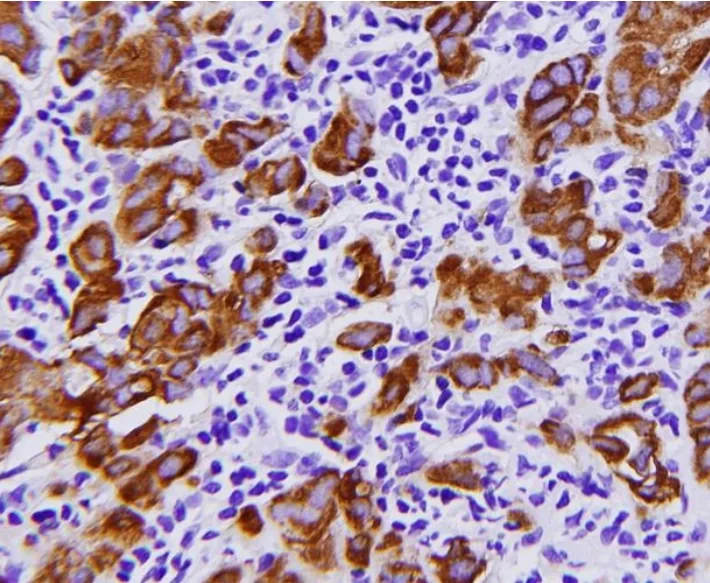 免疫组化镜检 在镜检前可以通过相关资料查询抗体的表达部位:细胞间质