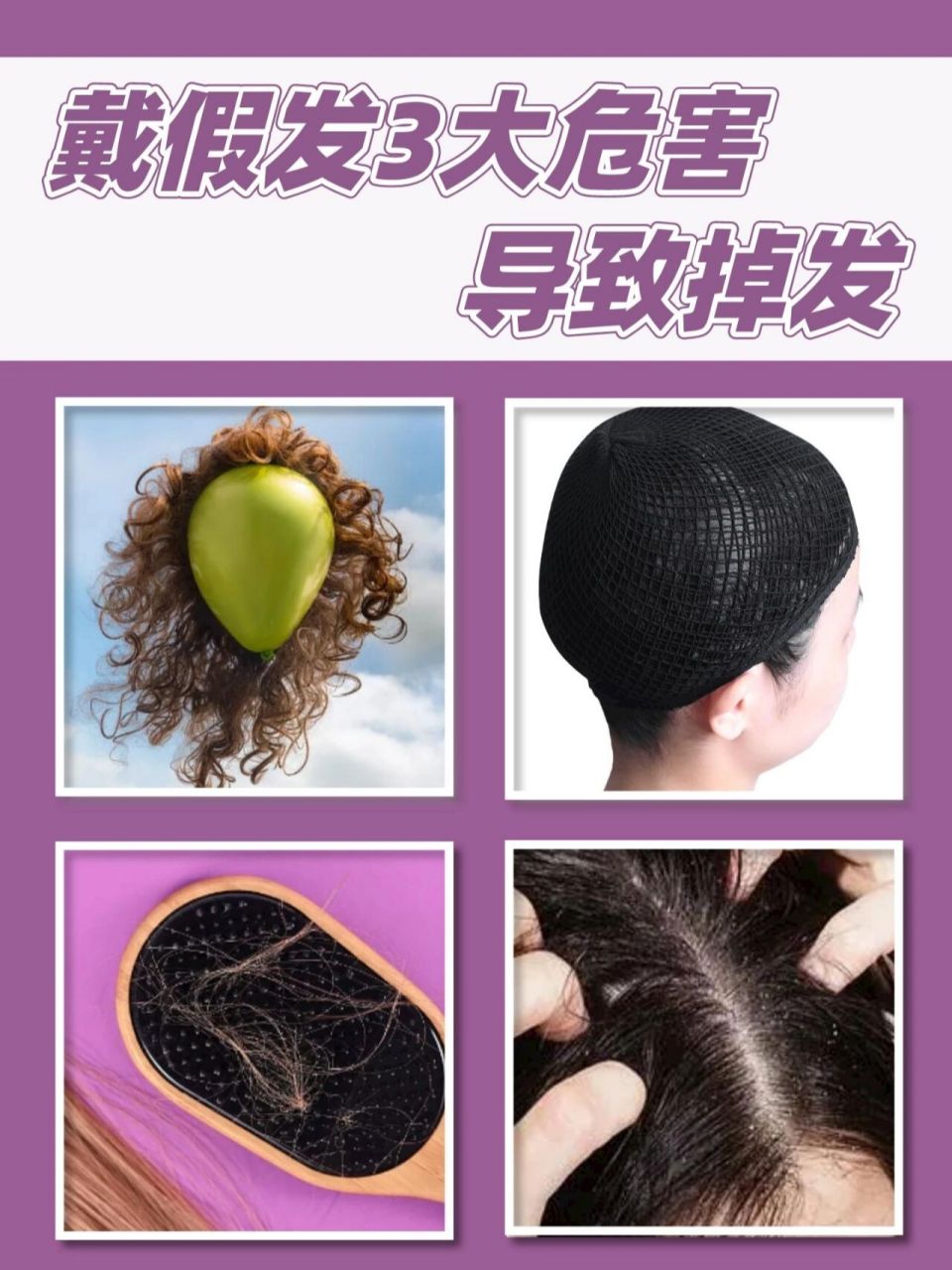戴假发导致掉发的36615大危害 96在日常生活当中有些人会因为