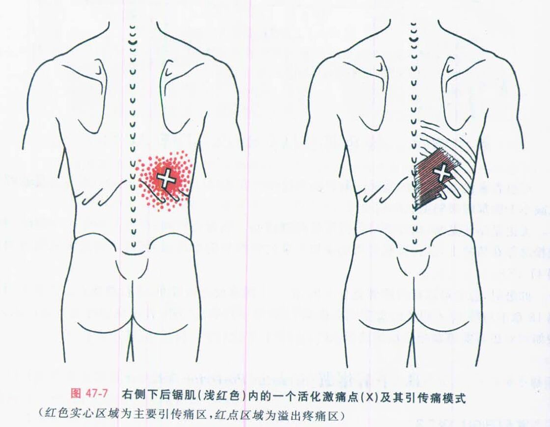 下后锯肌 在中轴-肋骨的连接的下后锯肌,从筋膜