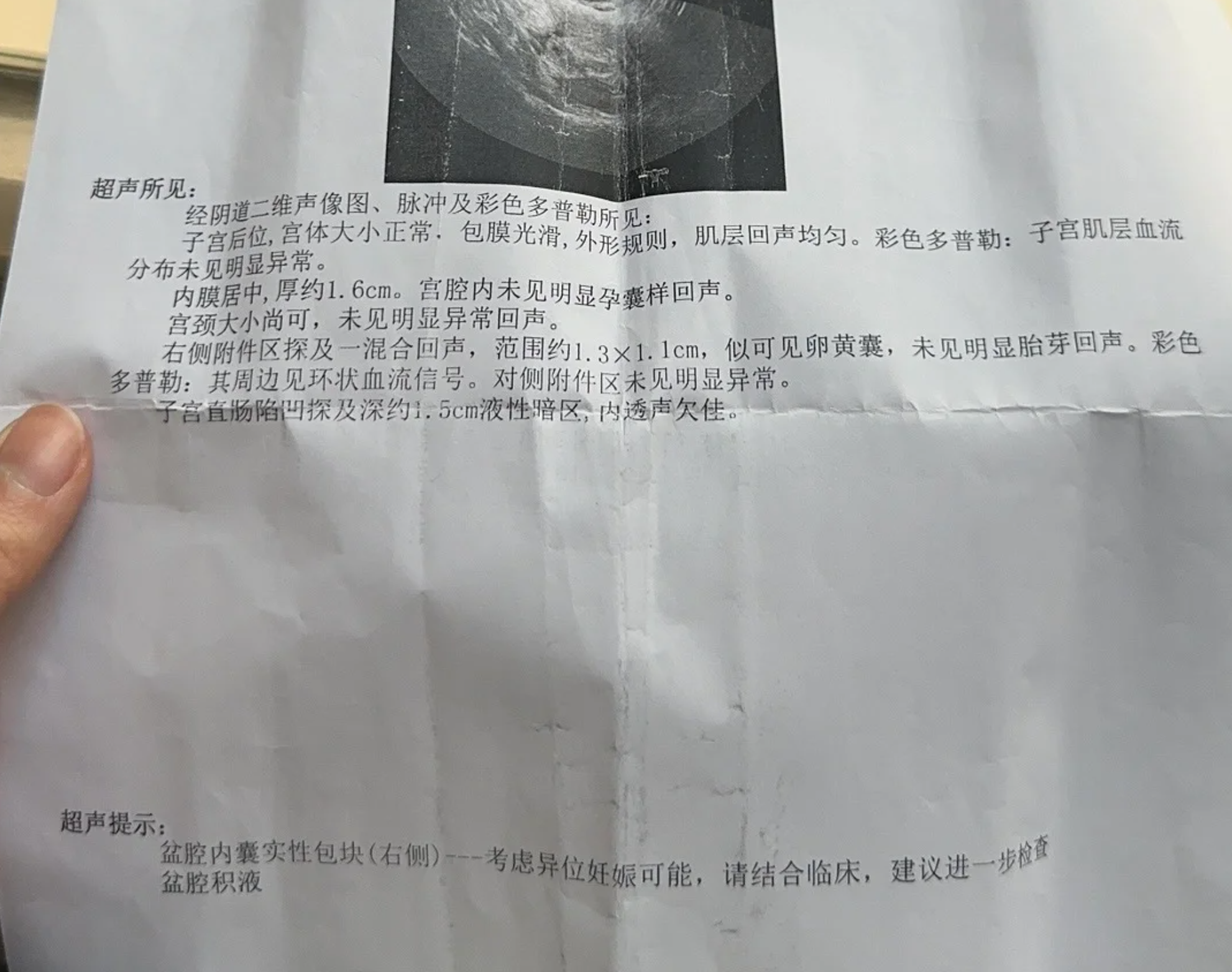 怀孕40天能不能做无痛人流,主要看检查结果