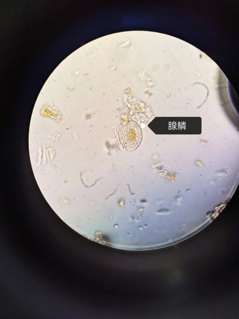 薄荷粉末显微鉴别 1.非腺毛 2.气孔 3.橙皮苷结晶 4.腺鳞