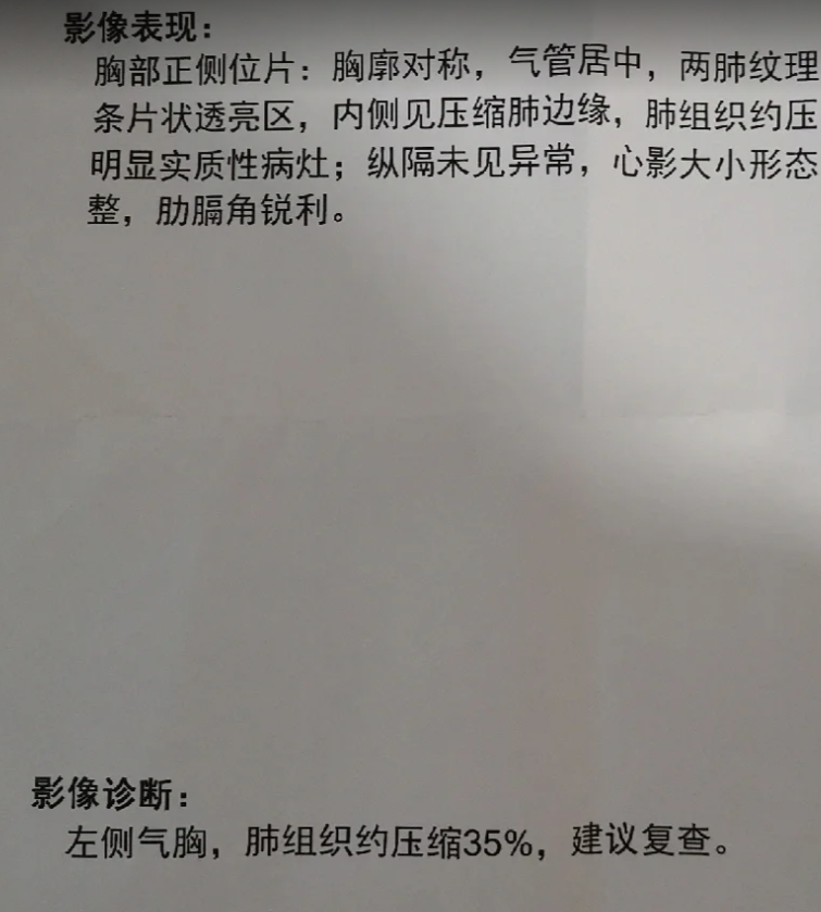 关于东方医院号源查询CT加急的信息 关于东方医院号源查询CT加急的信息