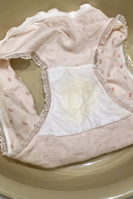 妇科淋巴结问题通常是指女性阴道淋巴结炎