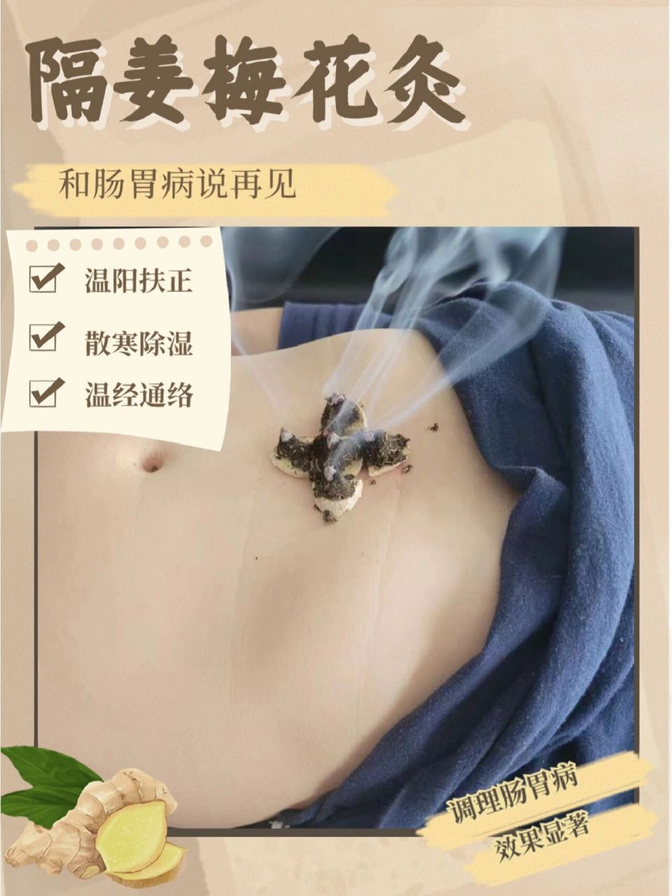 梅花灸治疗一切胃病 隔姜梅花灸治胃胀,反酸,呕吐73  "腑会中脘"