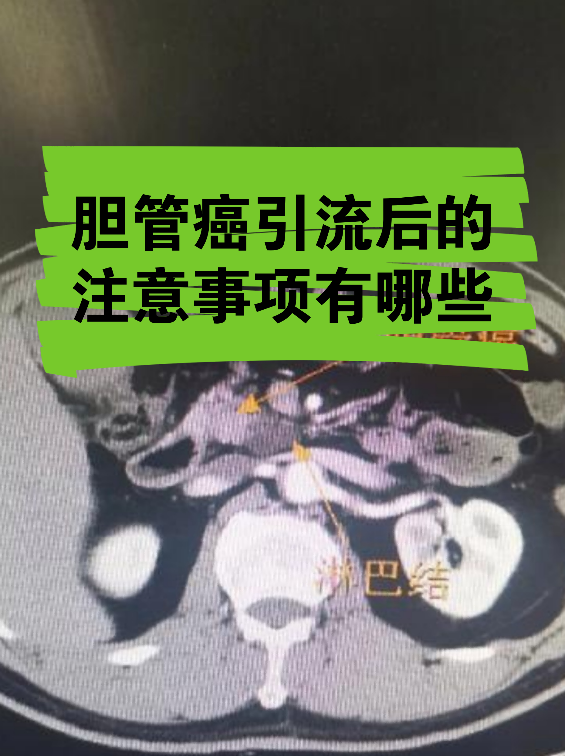 关于友谊医院检查陪护加挂号出院居家护理提醒，科学恢复身体的信息