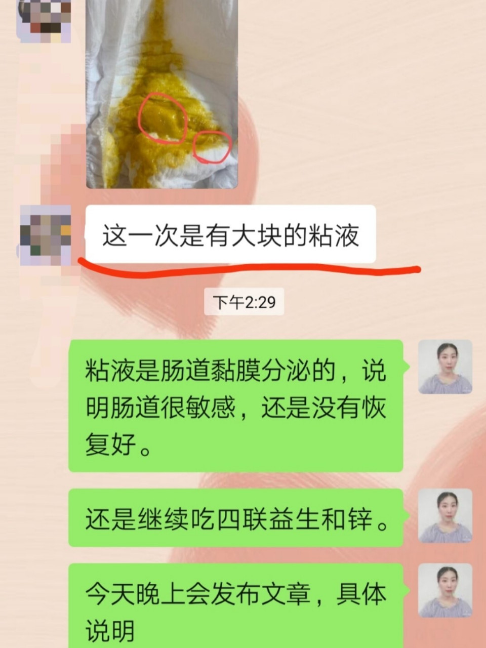 正常的肠道粘液图片图片