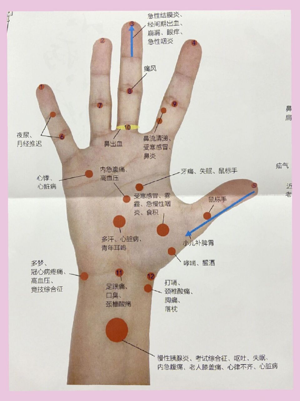 左右手都93一直在找的手部穴位图来喽收藏 不藏着掖着了,我的压箱底