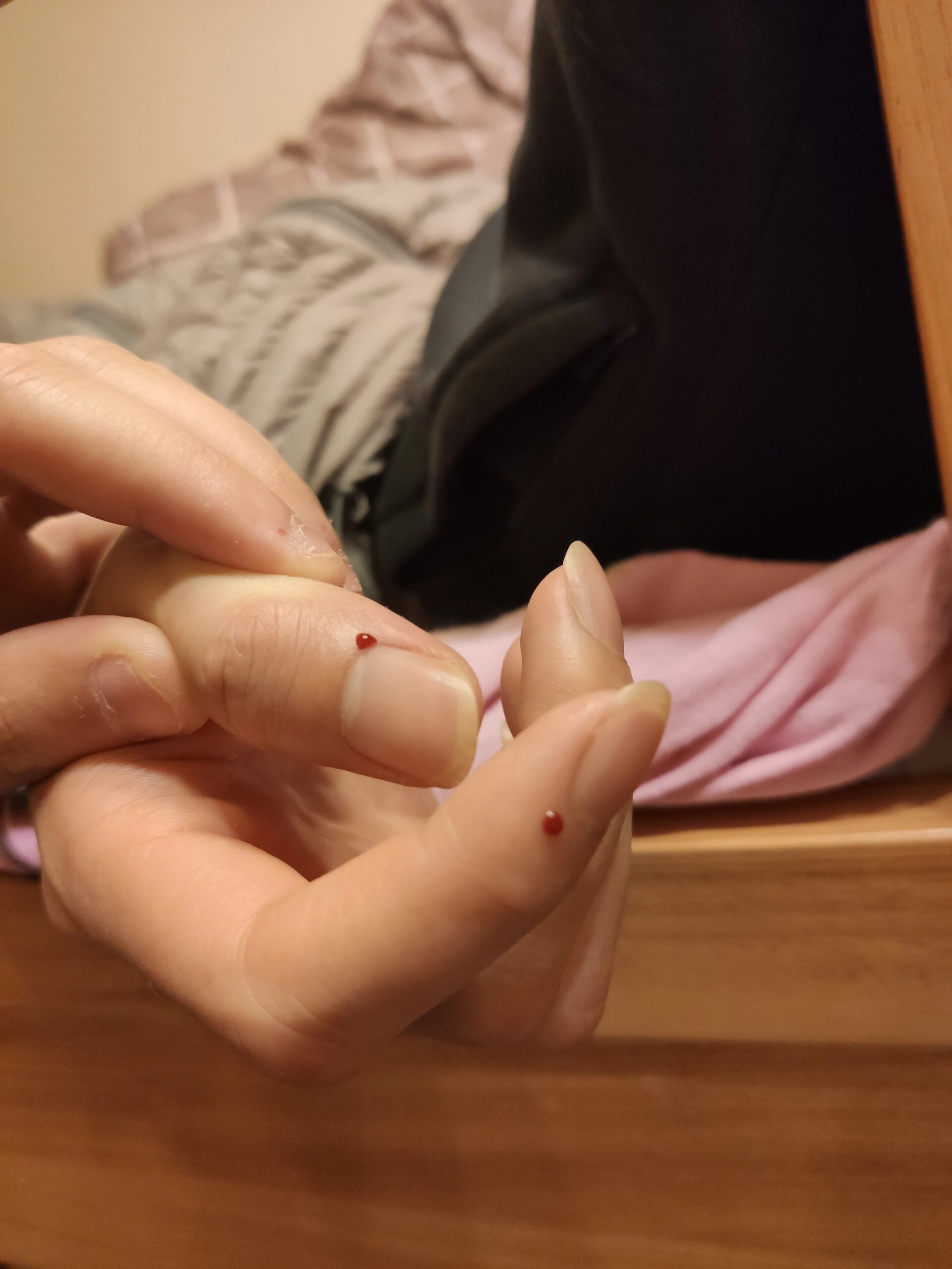 4,很难受,经他的同意下给他放血降温.