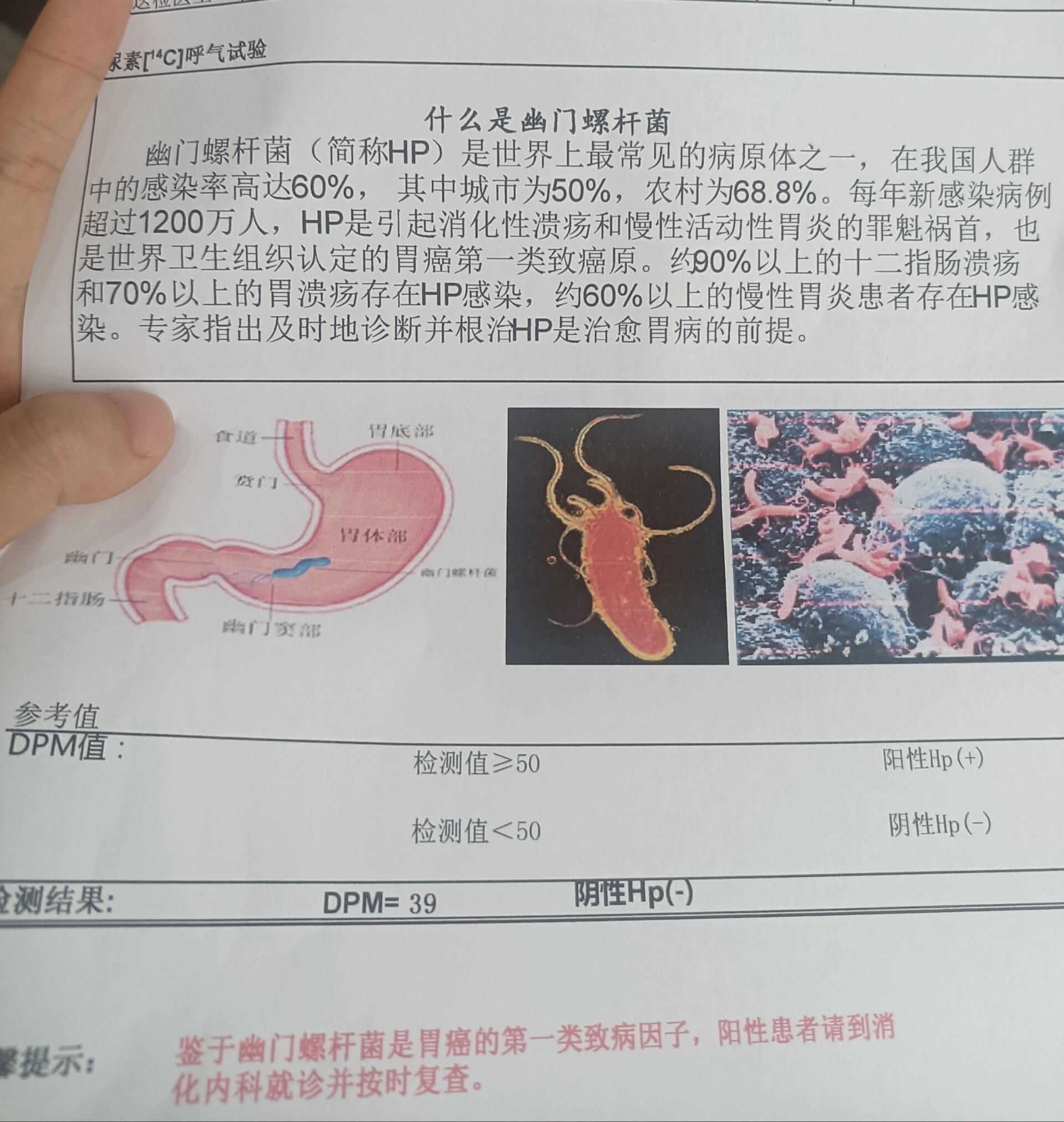 胃病化验单图片