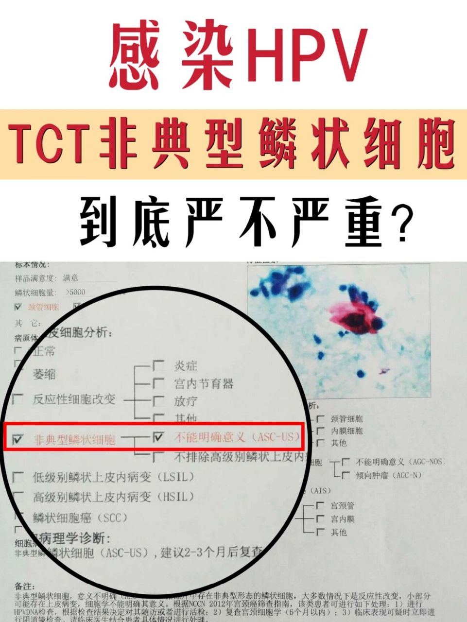 tct非典型鳞状细胞,可能炎症,也可能ai症 大家好,我是中医妇科马珊