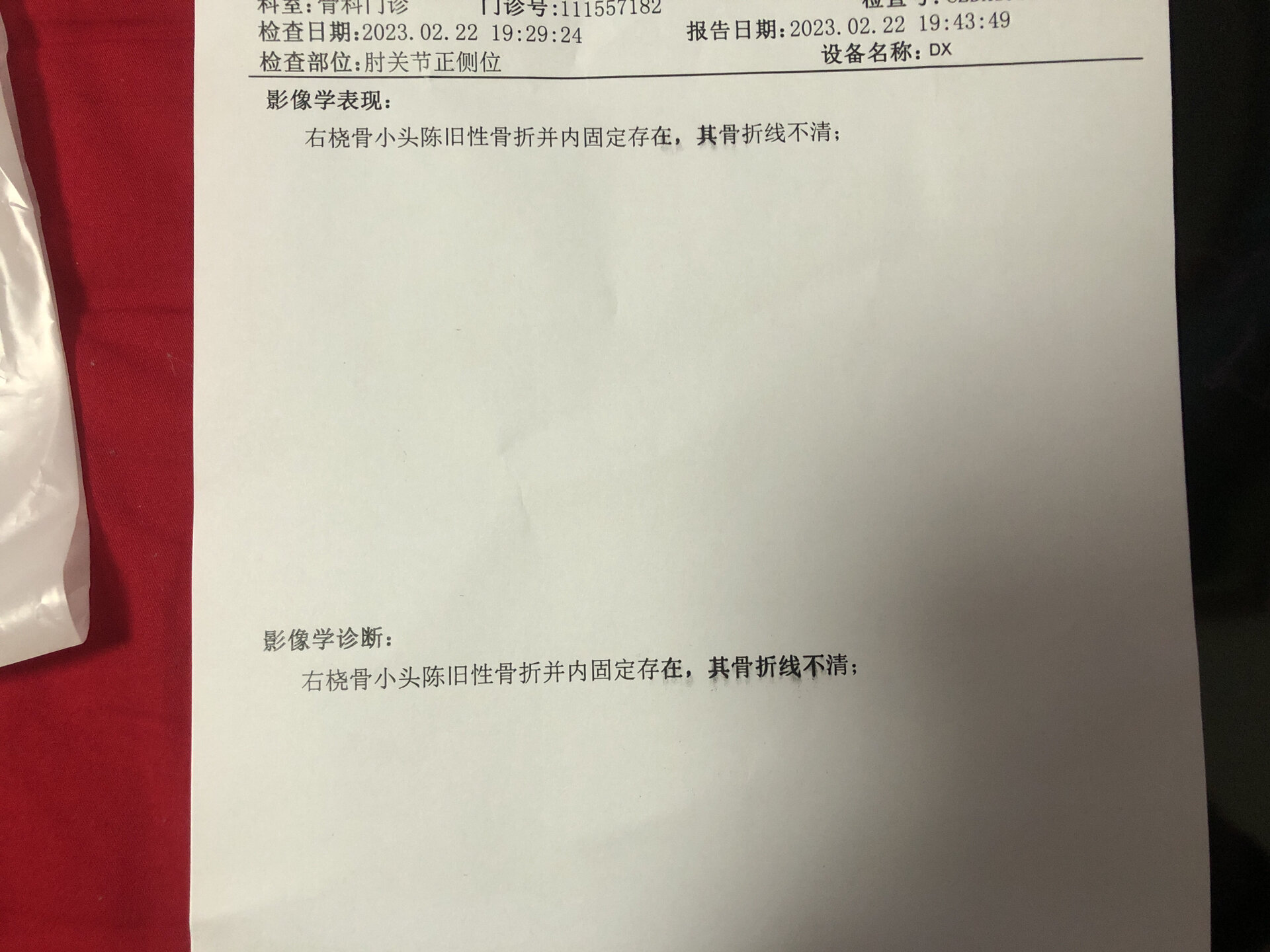 右桡骨小头骨折 骑电瓶车不小心摔倒致右手的桡骨骨折,已经两年了.