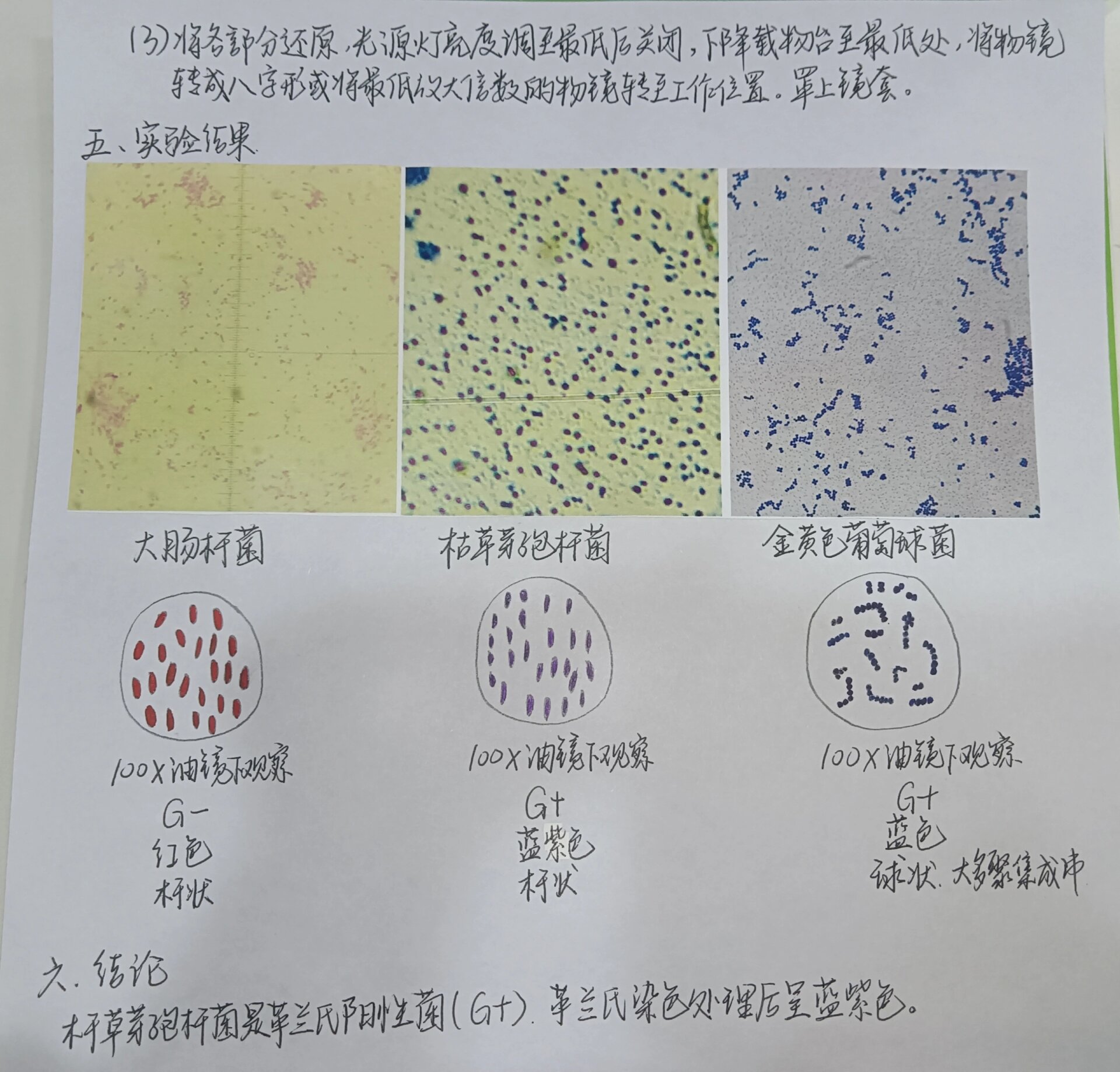 枯草芽孢染色手绘图图片