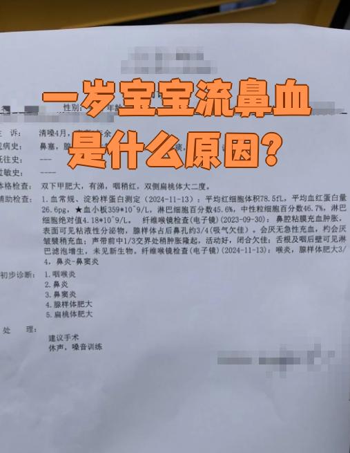 小孩为什么总是流鼻血是什么原因为什么在线 小孩为什么总是流鼻血是什么原因为什么在线