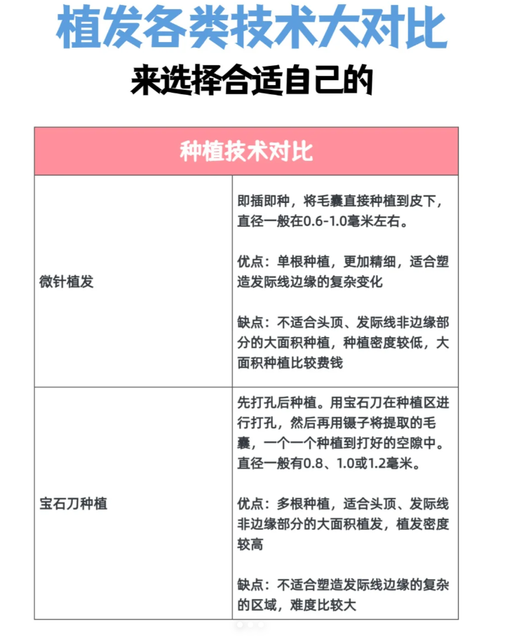 植发需要技术吗(植发需要技术吗百度百科)
