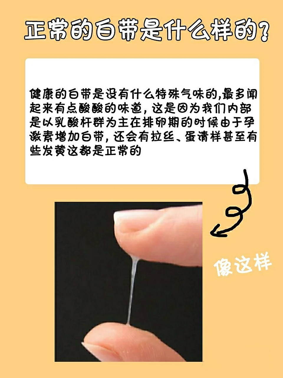 快来对比一下 你的白带什么样
