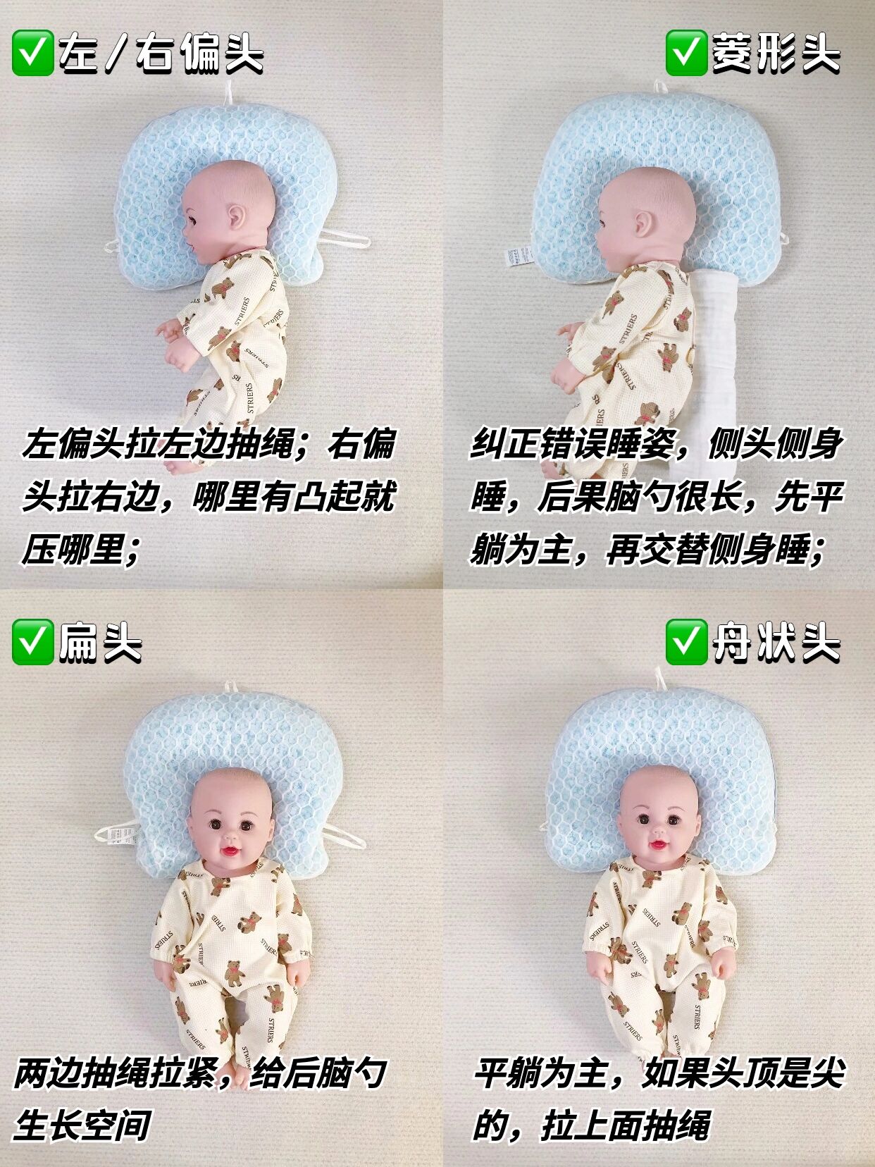 头型矫正从小抓起终于把周状头睡成小圆头 从出生后小糯米就一直侧睡