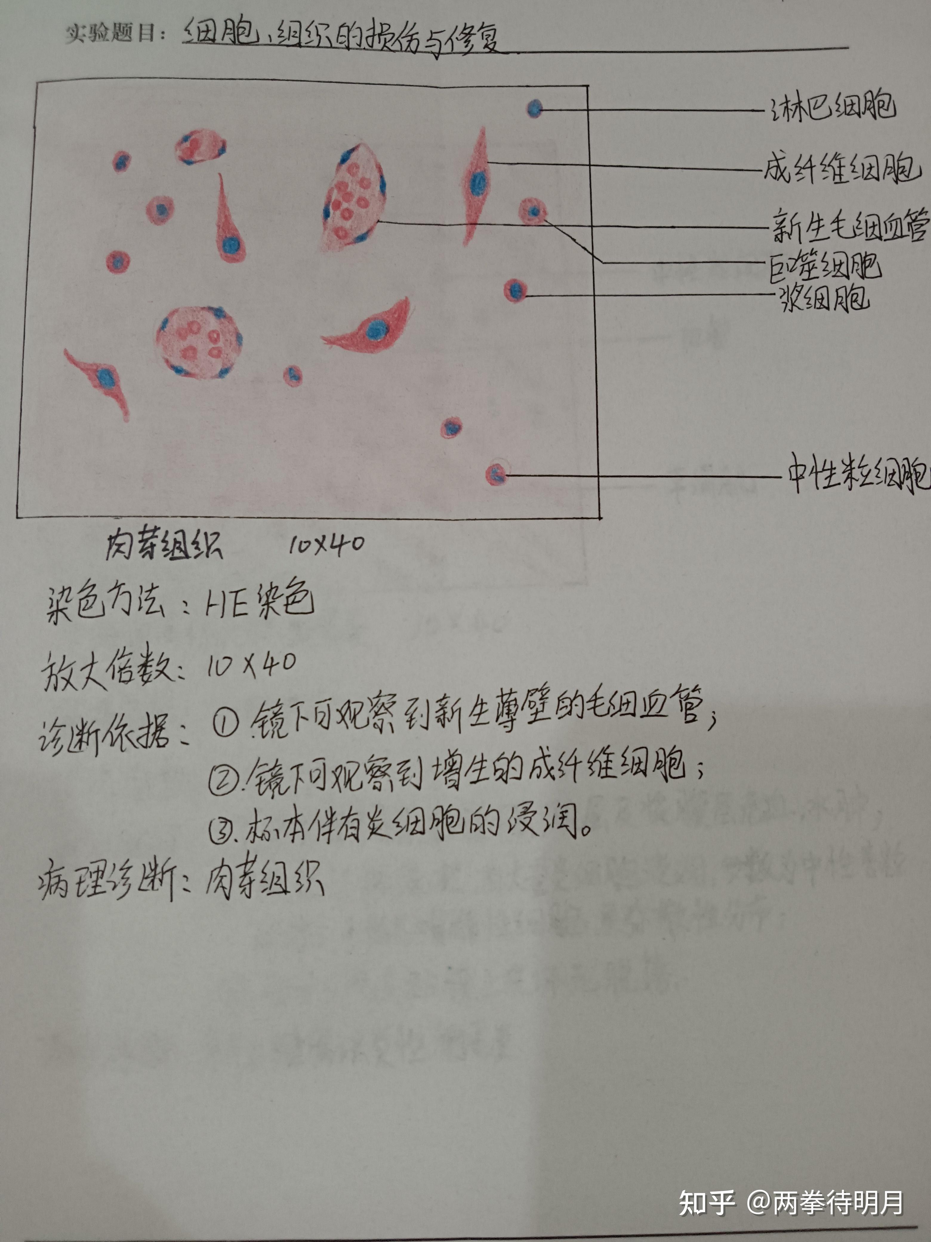 肉芽细胞红蓝铅笔图图片