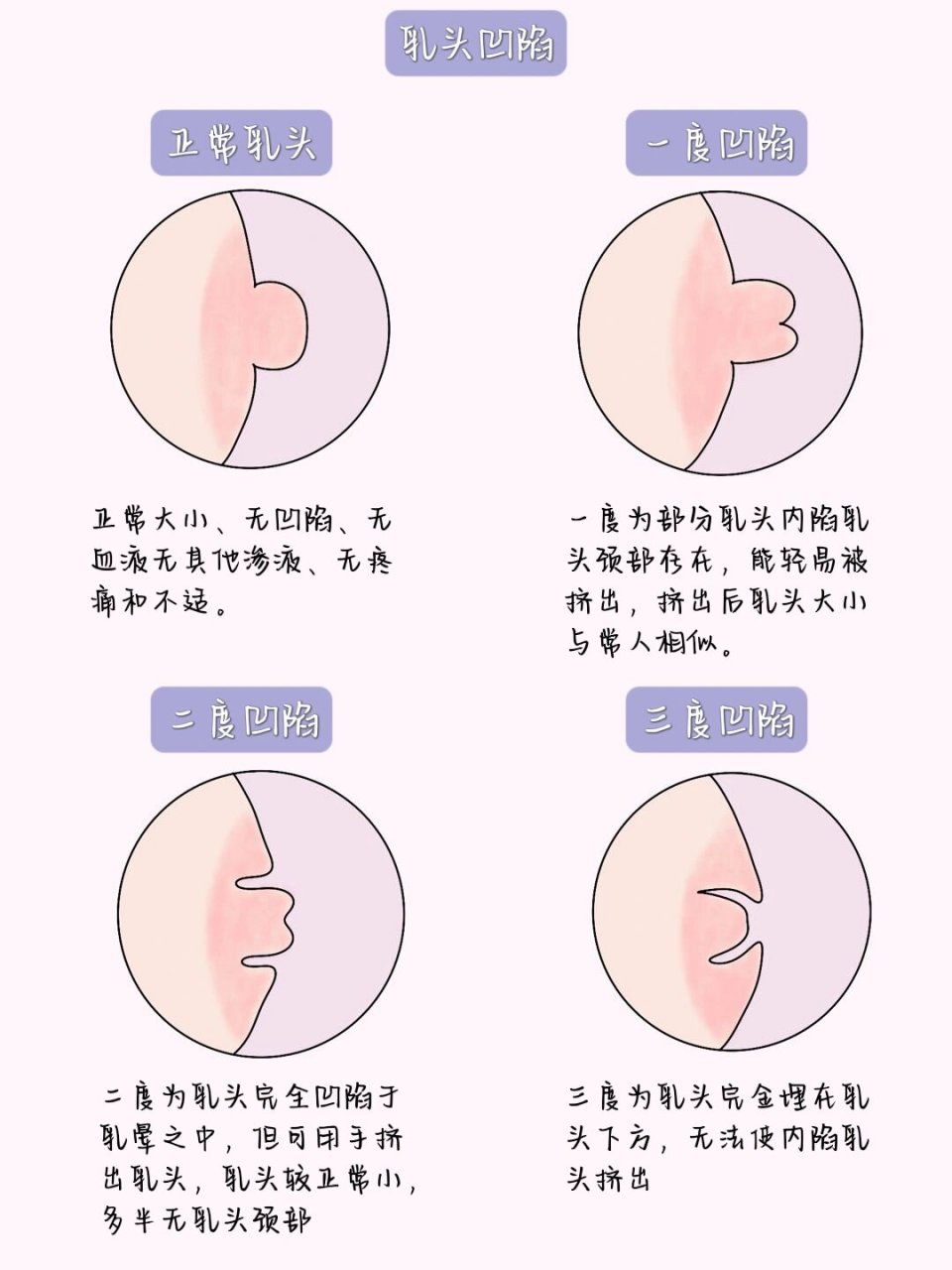 医学生笔记7199(妇科篇)/乳头内陷      乳房自检六步骤 ①举手