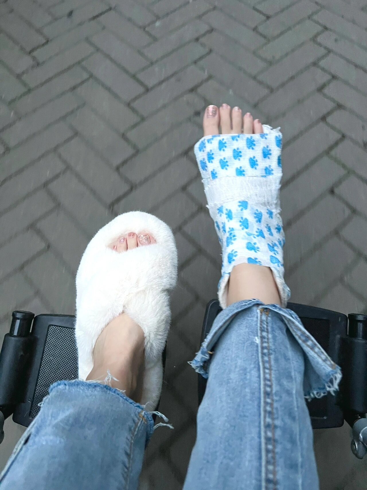 骨折女孩|秋日ootd 康复训练中 早日脱离拐 秋天都到了 夏天还会远吗