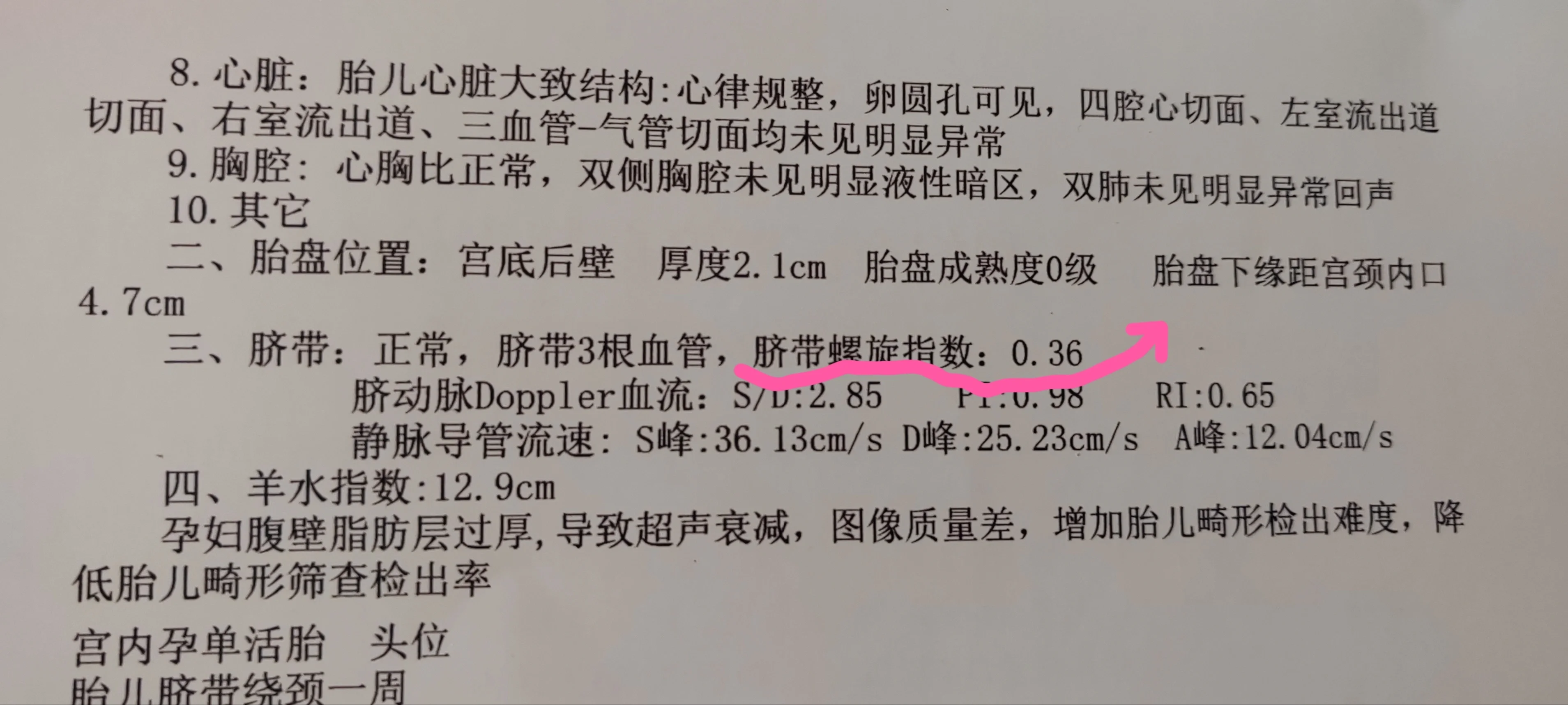 脐带扭转的量化指标:脐带螺旋指数