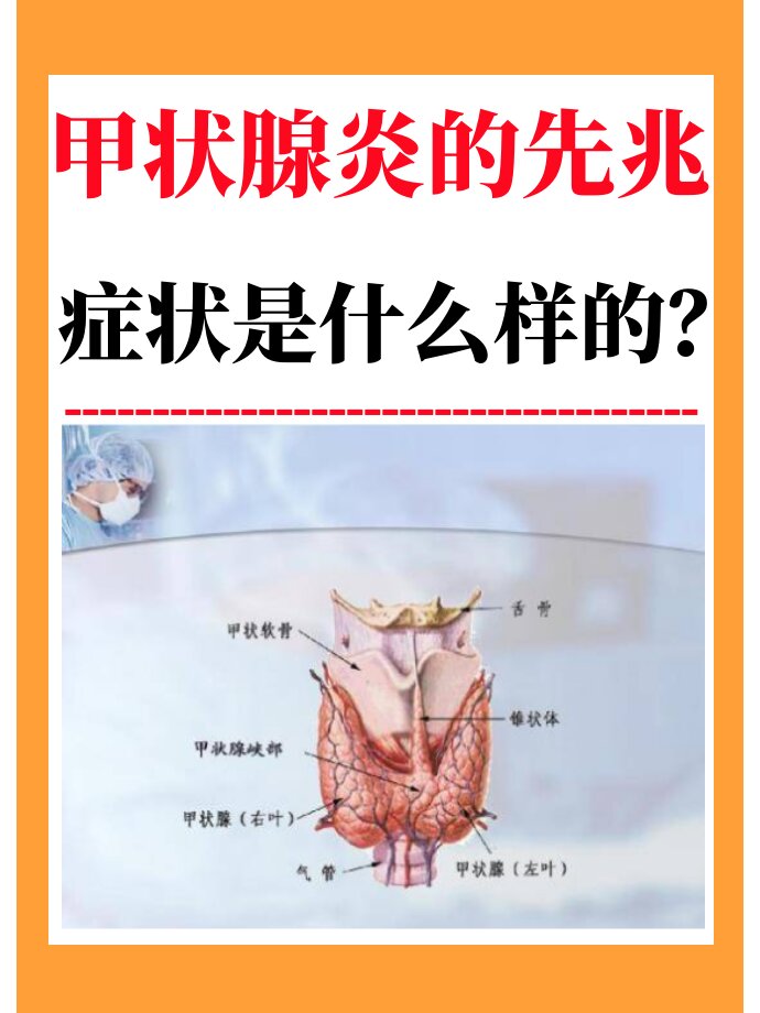 急性甲状腺炎: 1早期 (1)起病多急骤,呈寒战,发热