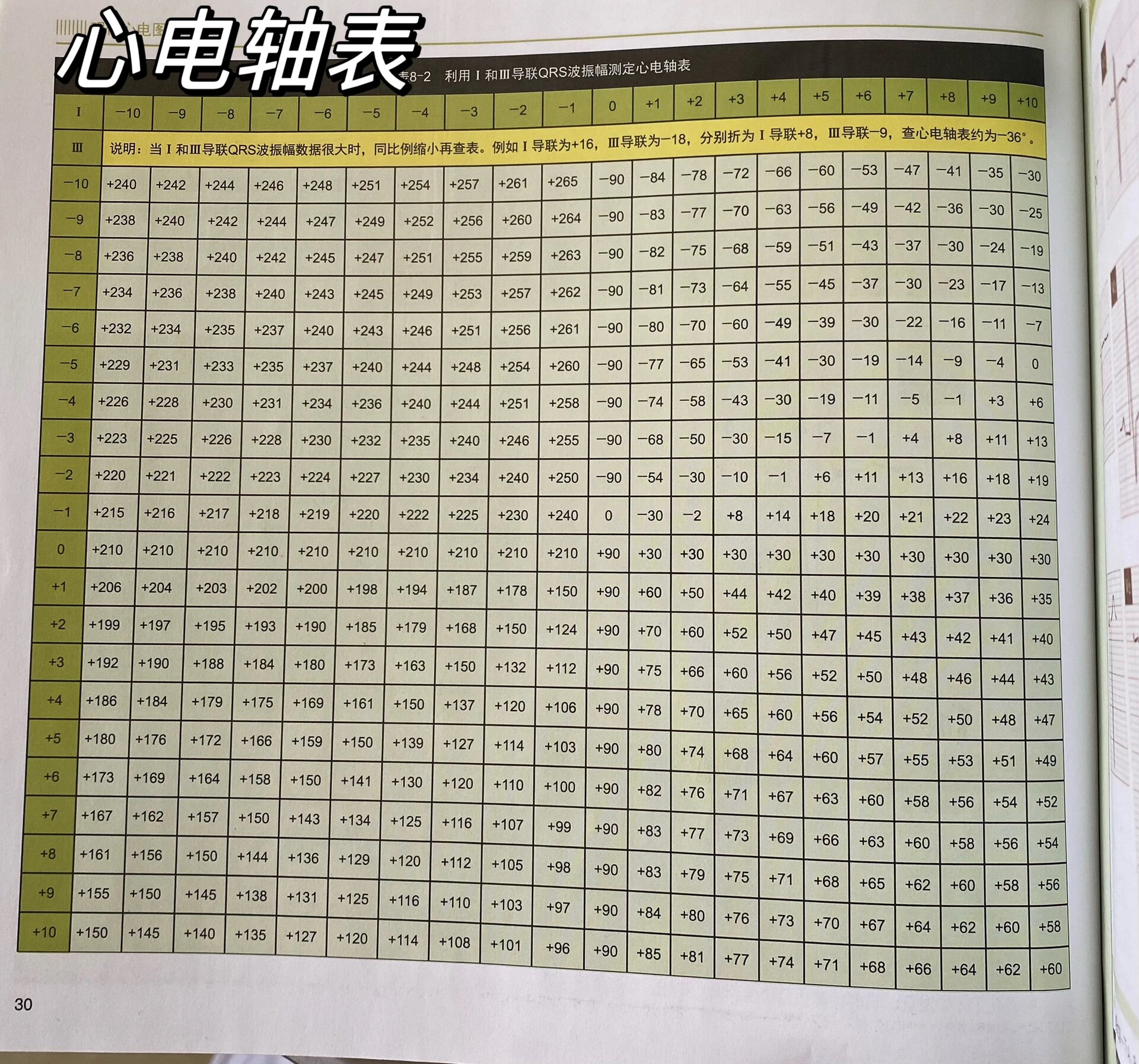 学习心电图之心电轴