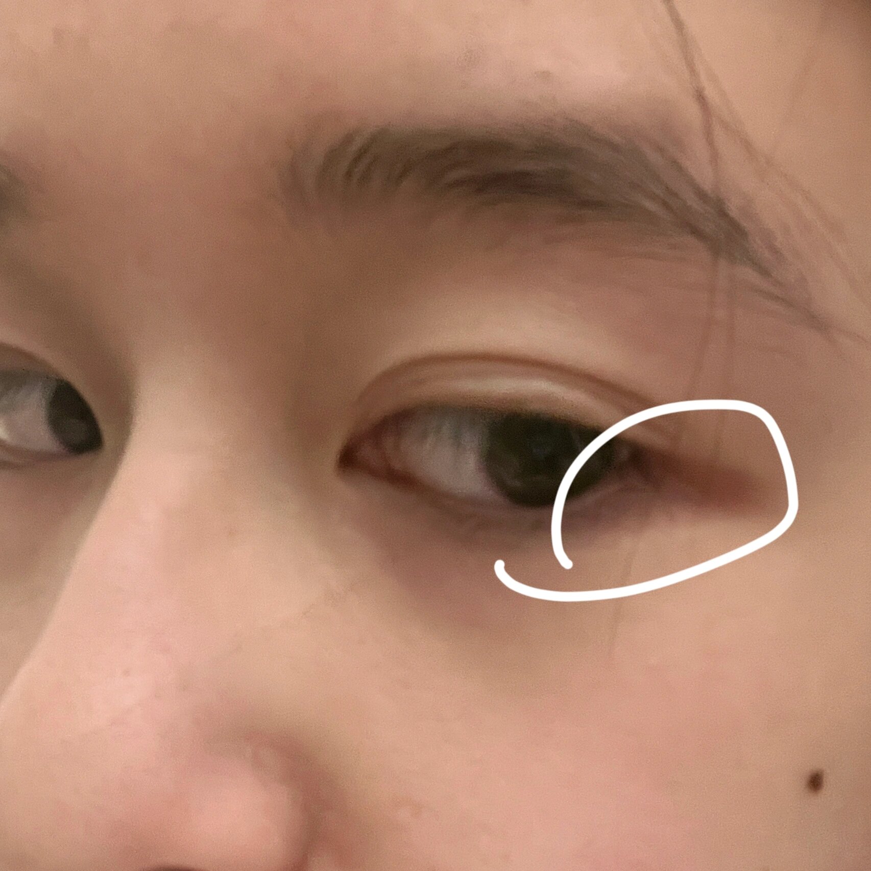 原来它叫眼尾沟!