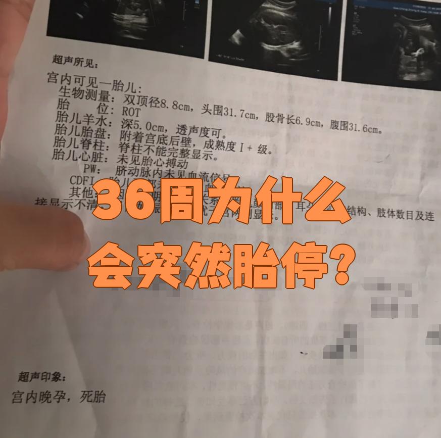 为什么胎停