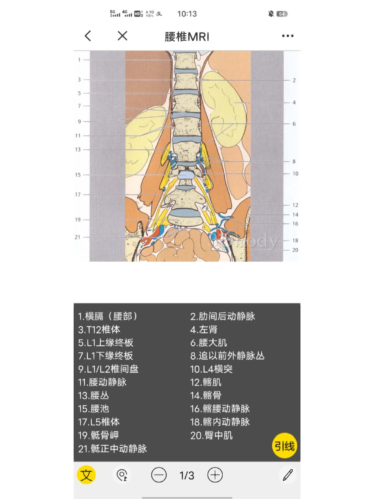 腰椎断层解剖及mri影像(冠状位)③