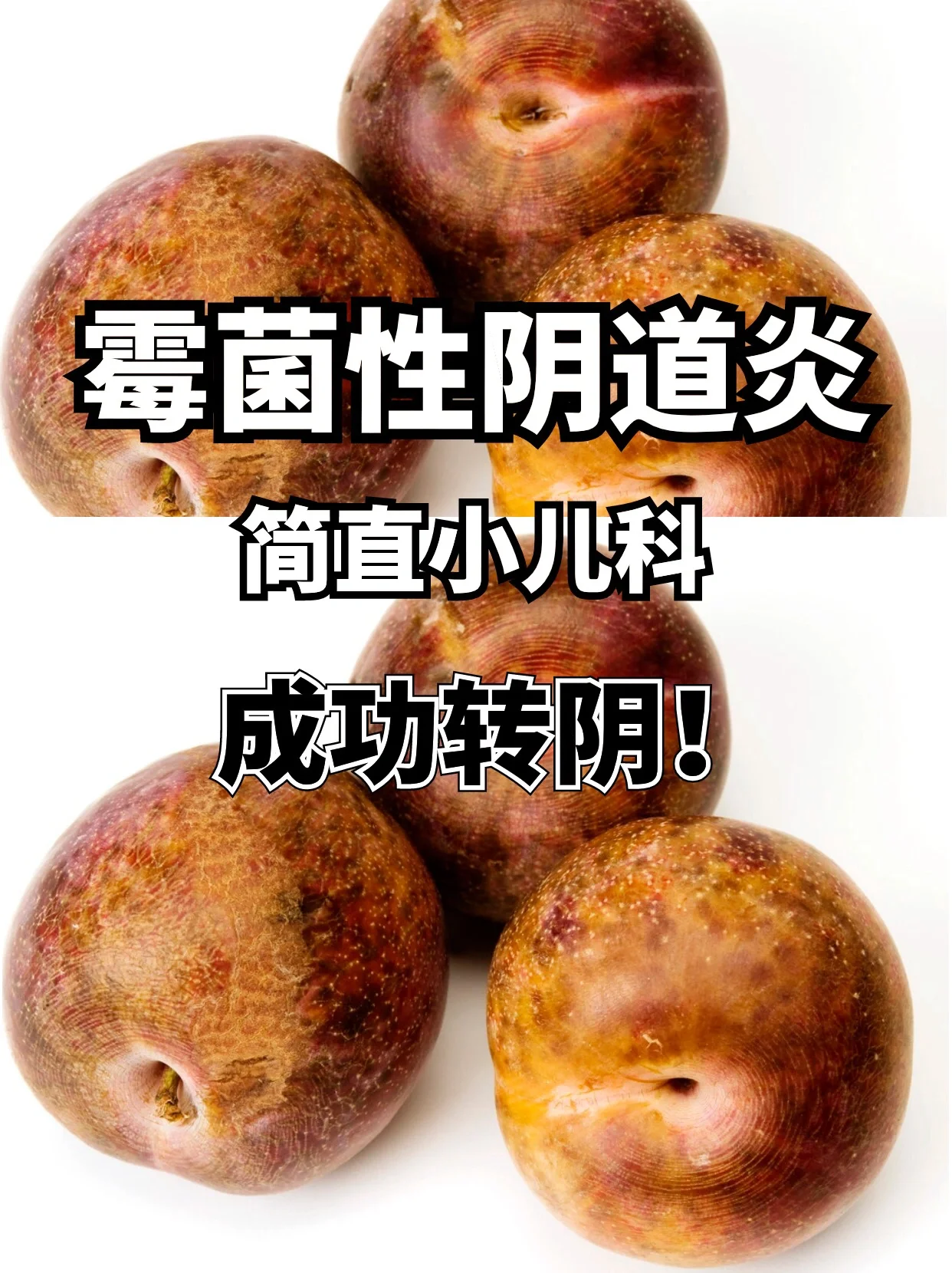 女性霉菌是什么病的简单介绍 女性霉菌是什么病的简单

先容
（女性霉菌是什么病菌） 女性