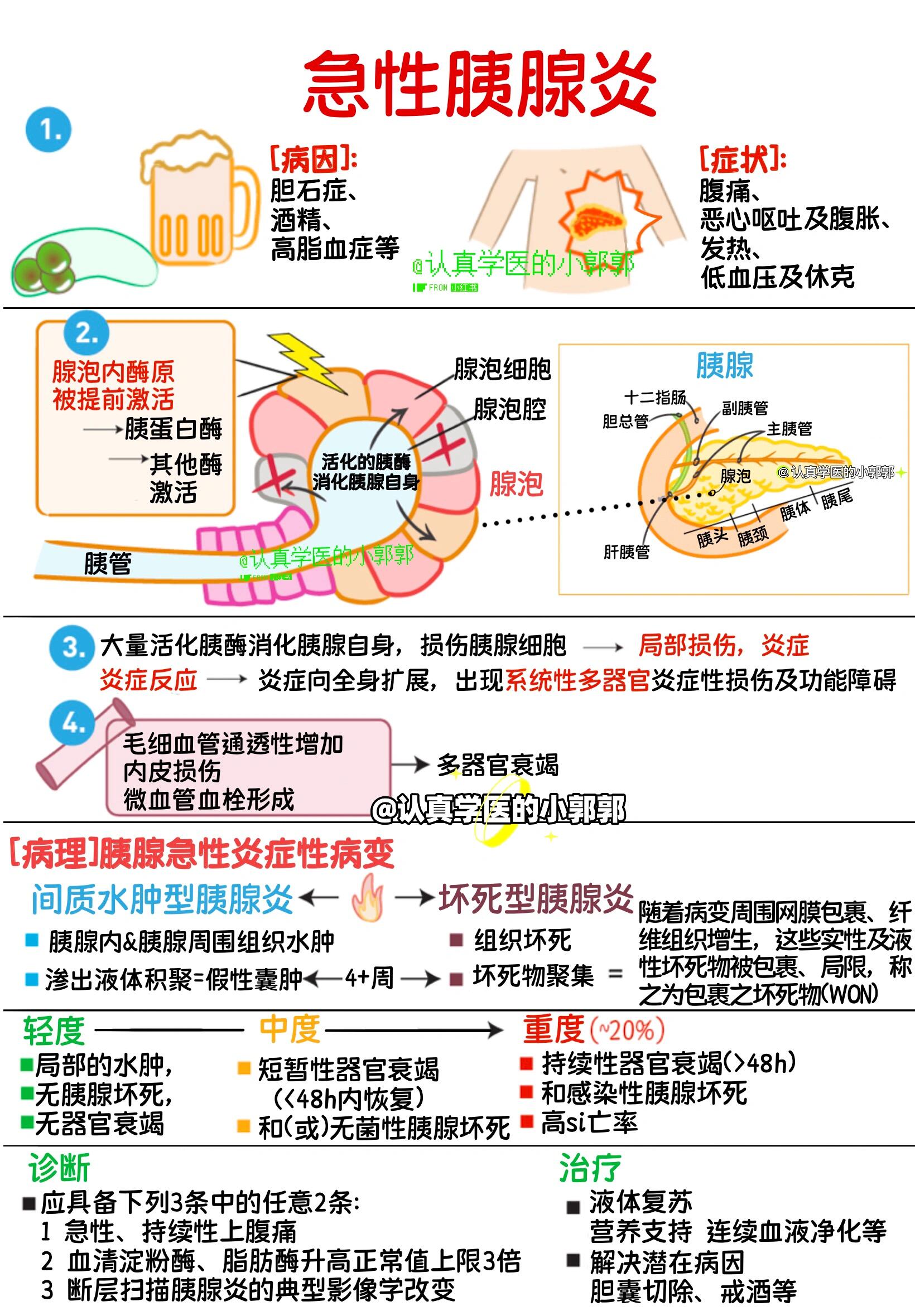 一图看懂急性胰腺炎