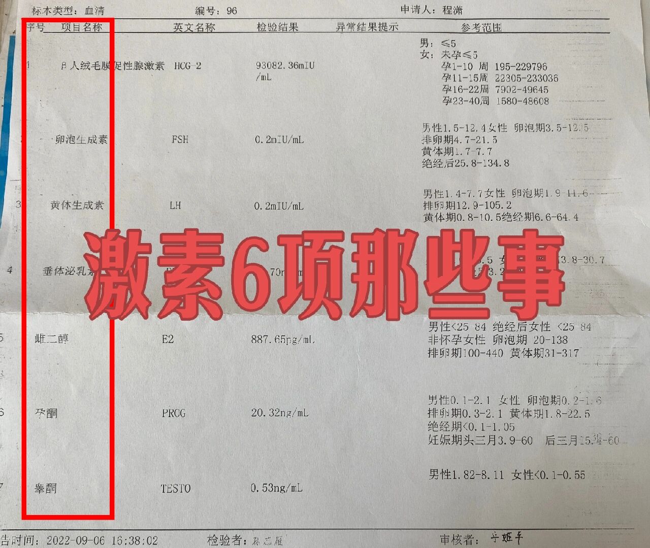 性激素六项检查主要用于判断月经失调,卵巢功能早衰或不孕不育等